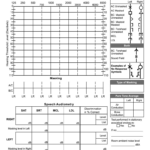 Blank Audiogram Template   Fill Online, Printable, Fillable, Blank In Free Printable Blank Audiogram Template