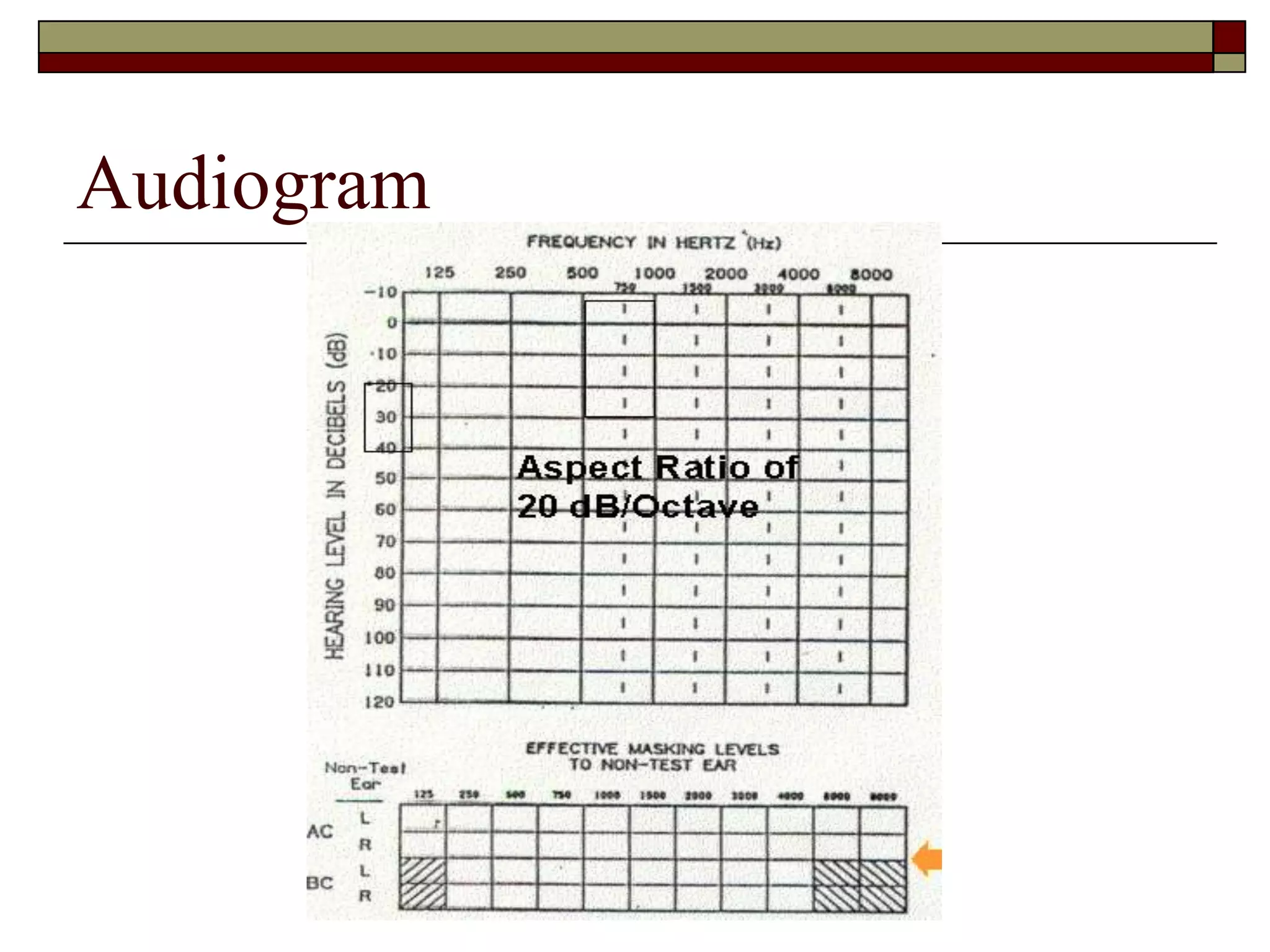 Intro Audiology Intro Audiology